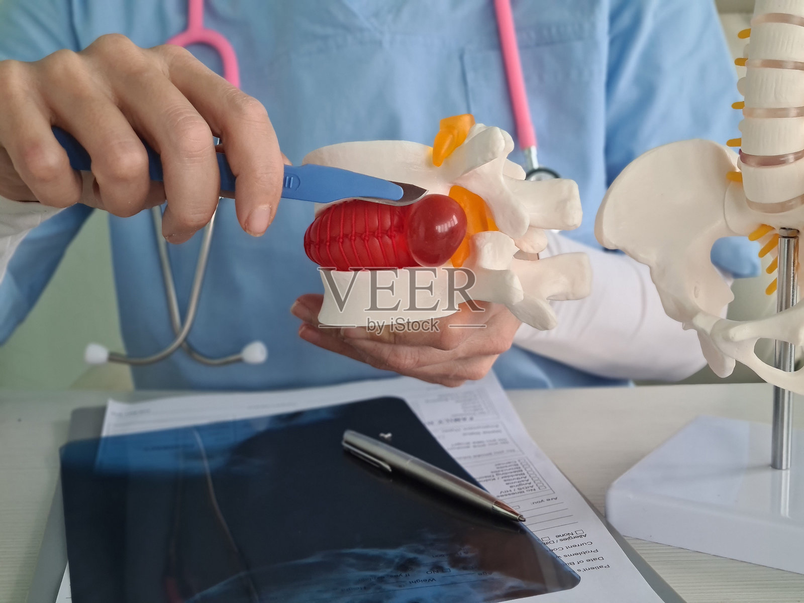 椎间疝与手术概念照片摄影图片