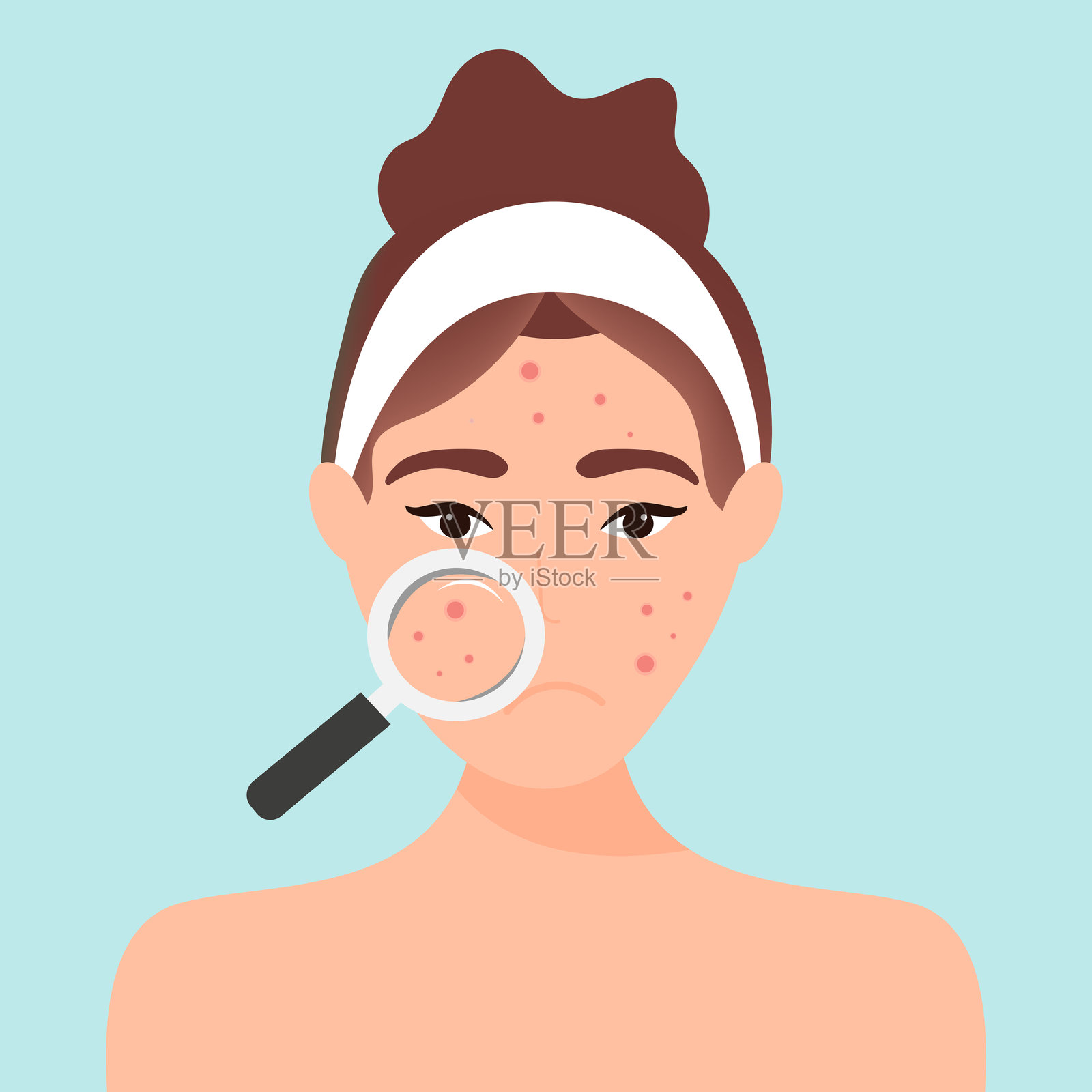 年轻少女,脸上有红色痘痘。矢量插图。插画图片素材