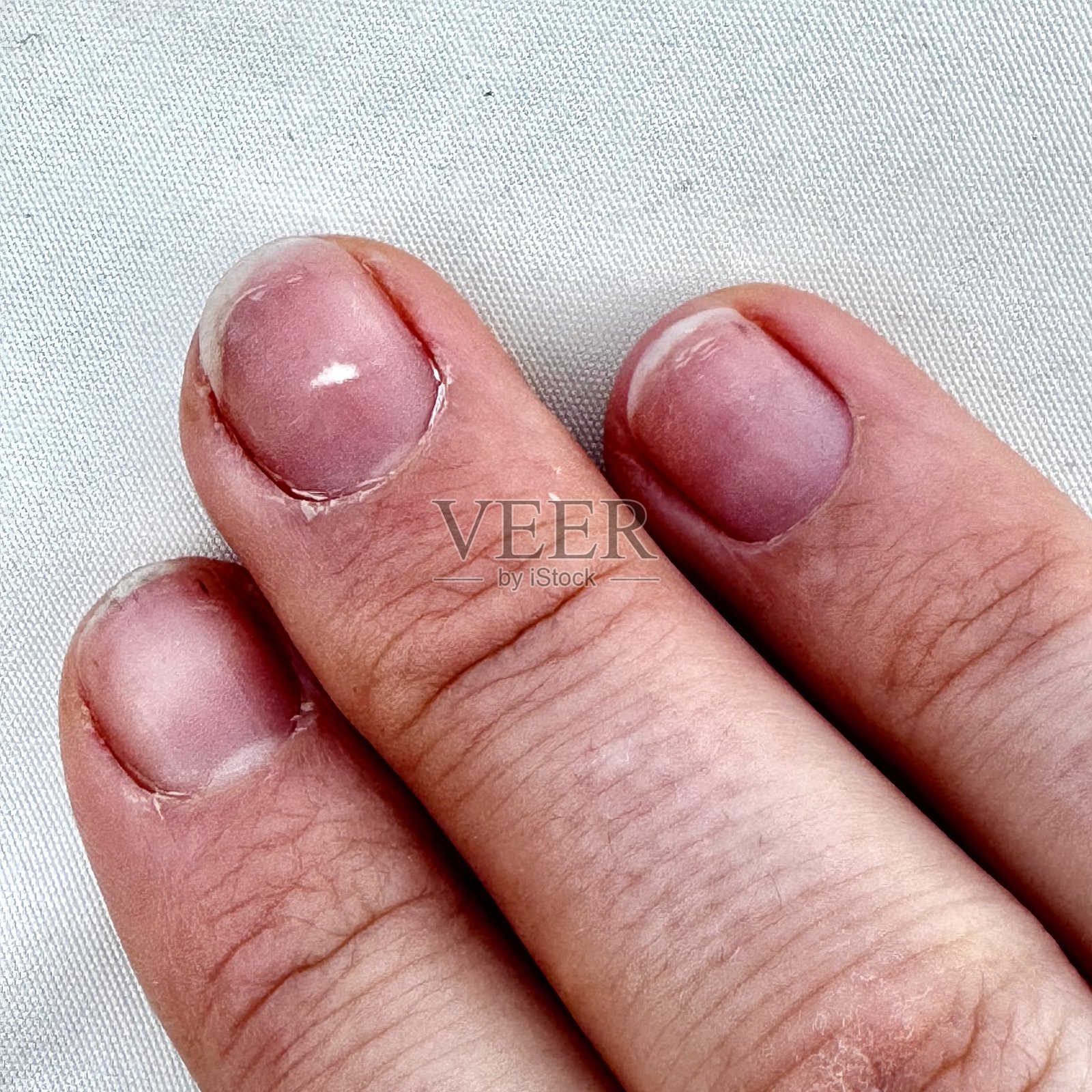 指甲特写显示健康状况照片摄影图片