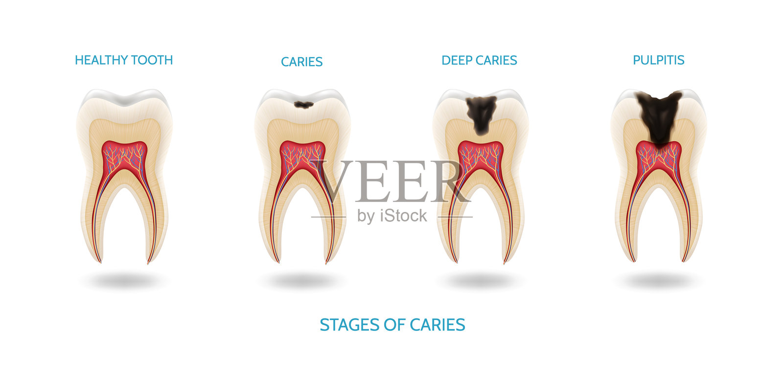 现实主义风格的牙齿,展示不同类型的牙齿问题插画图片素材