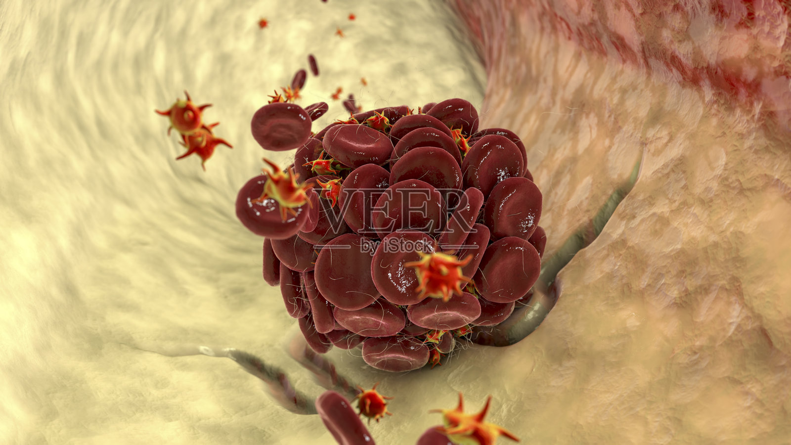 血栓,艺术作品照片摄影图片