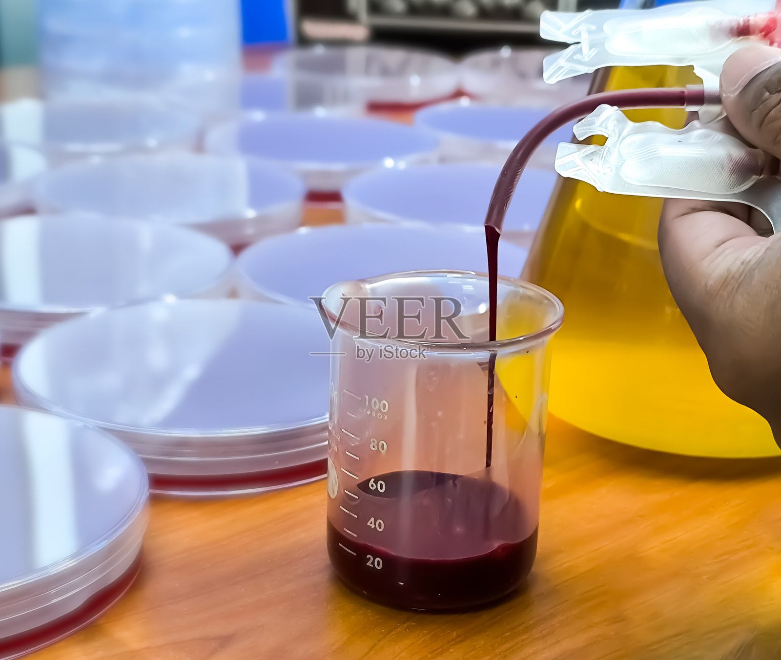 科学家手部特写,将血液琼脂培养基从血袋倒入罐中。倒血以制作琼脂培养基。照片摄影图片