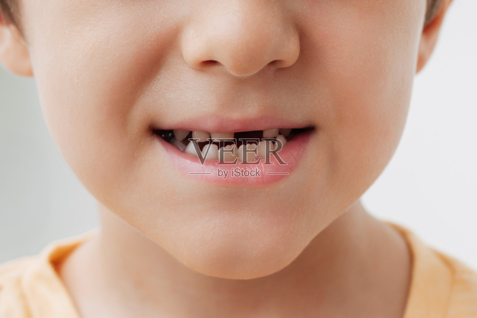 一个小男孩没有乳牙的微笑。孩子的前面乳牙掉了,新的恒牙长出来了。儿童口腔护理。照片摄影图片