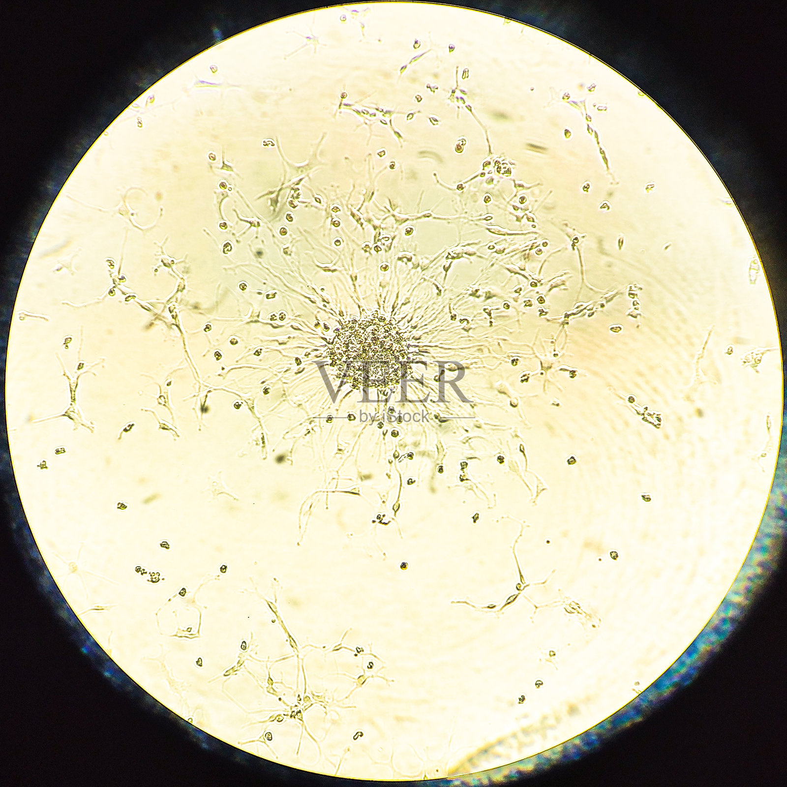 胶质母细胞瘤细胞球体。照片摄影图片