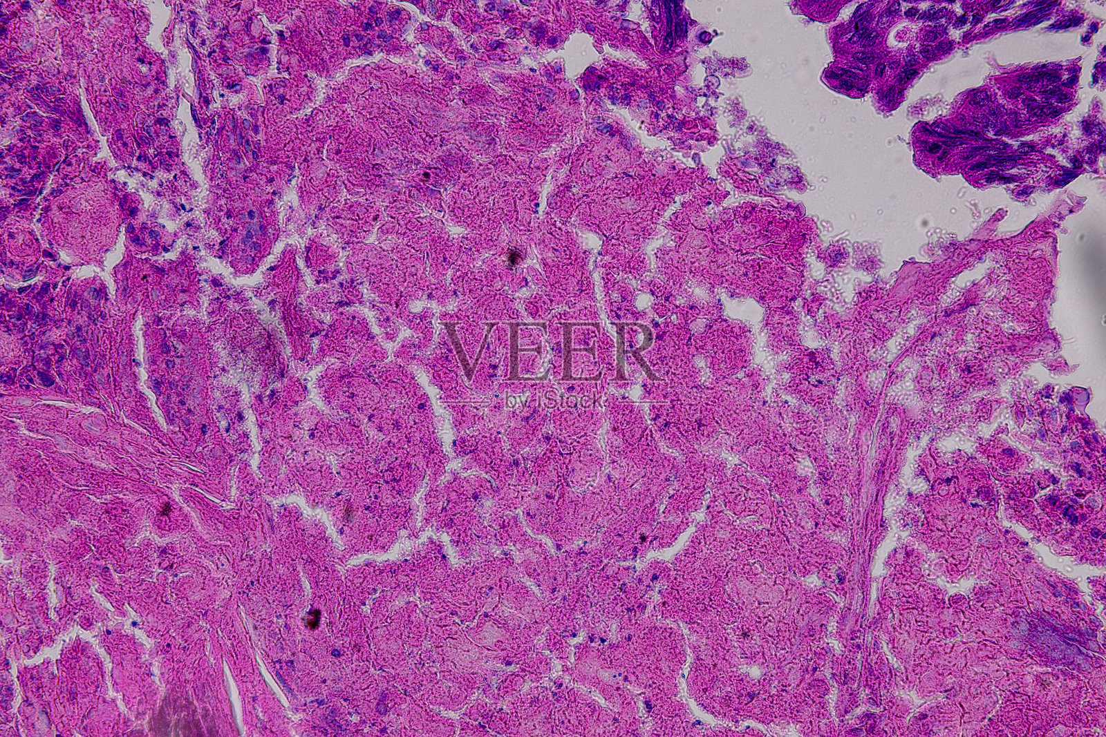 哺乳动物的病理学和组织学组织在显微镜下观察。照片摄影图片