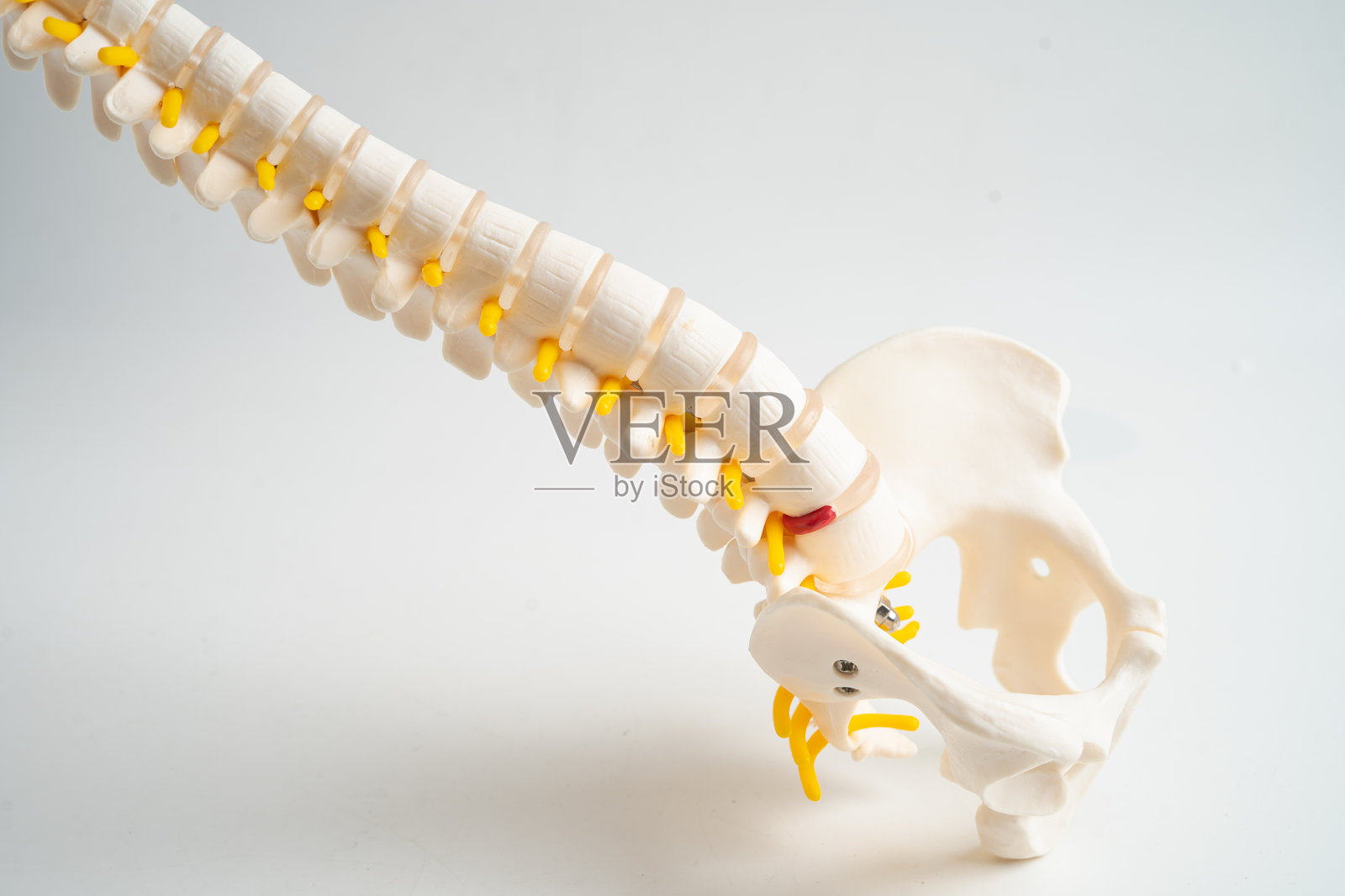 腰椎移位的椎间盘突出片、脊神经和骨骼。用于骨科治疗的医学模型。照片摄影图片