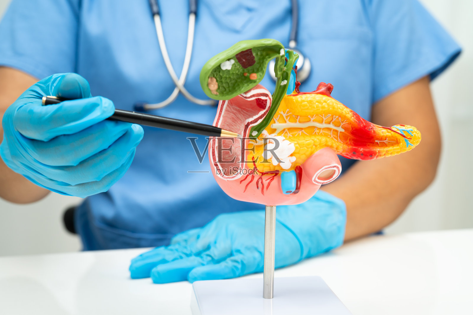 胰腺炎、胰腺癌,亚洲医生与医院的胰腺、胆囊和胆管人体解剖模型。照片摄影图片