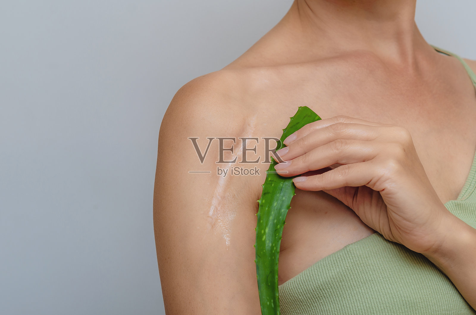 芦荟叶表示女性肩部的术后疤痕。疤痕愈合,皮肤疤痕的治疗。照片摄影图片