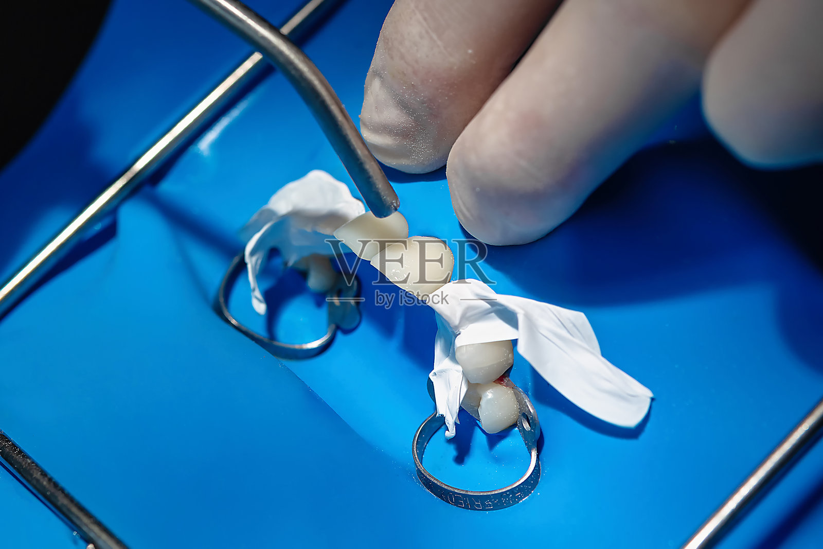 牙医在橡胶障碍隔离下为贴面粘合干燥牙齿照片摄影图片