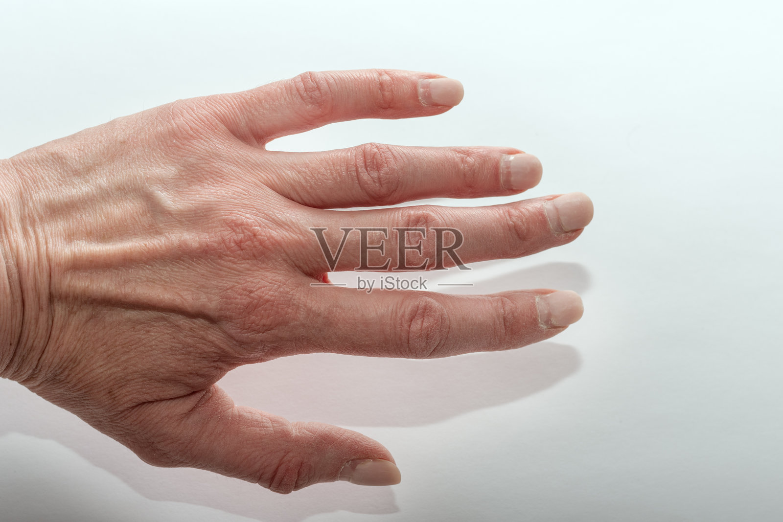 一只老年人的手特写,手上可见皱纹和静脉,背景为白色,象征着衰老和人体解剖。手和指甲的有害影响。照片摄影图片