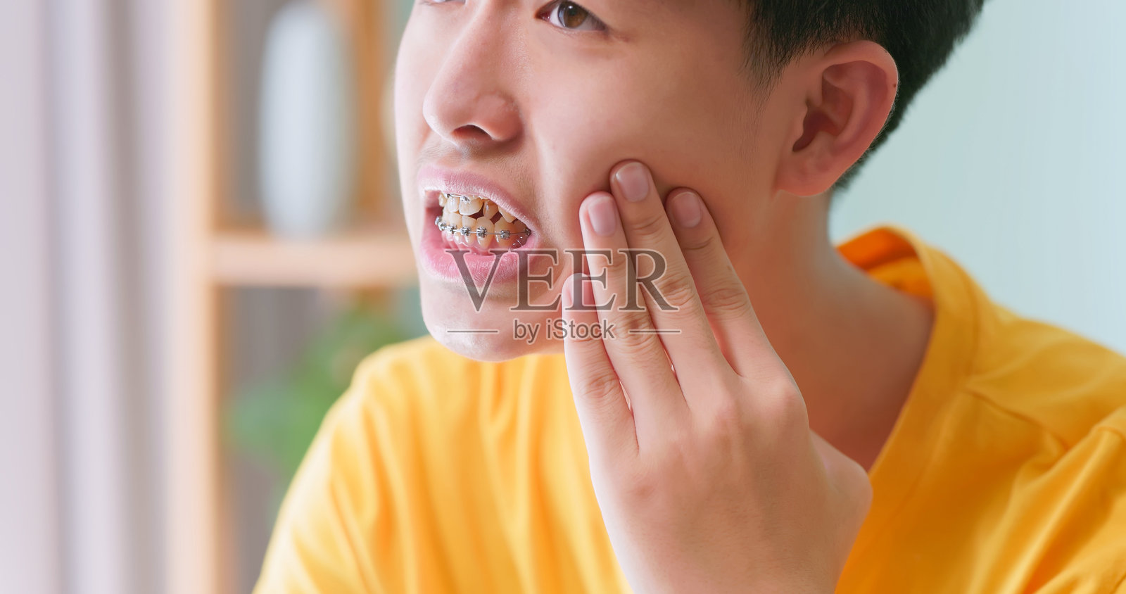 戴金属牙套的青少年感到疼痛和不适照片摄影图片