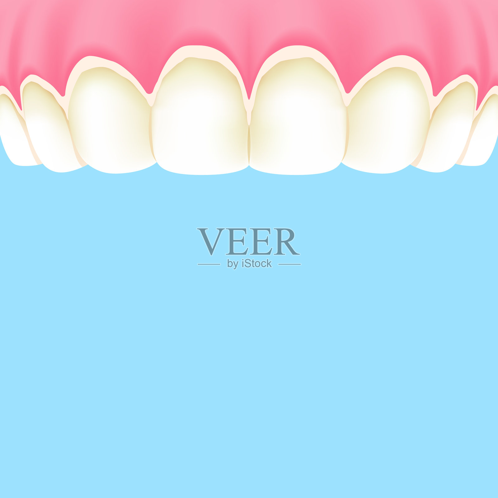 上牙(牙结石)- 文本框横幅(方形)插画矢量设计。牙齿护理概念。插画图片素材