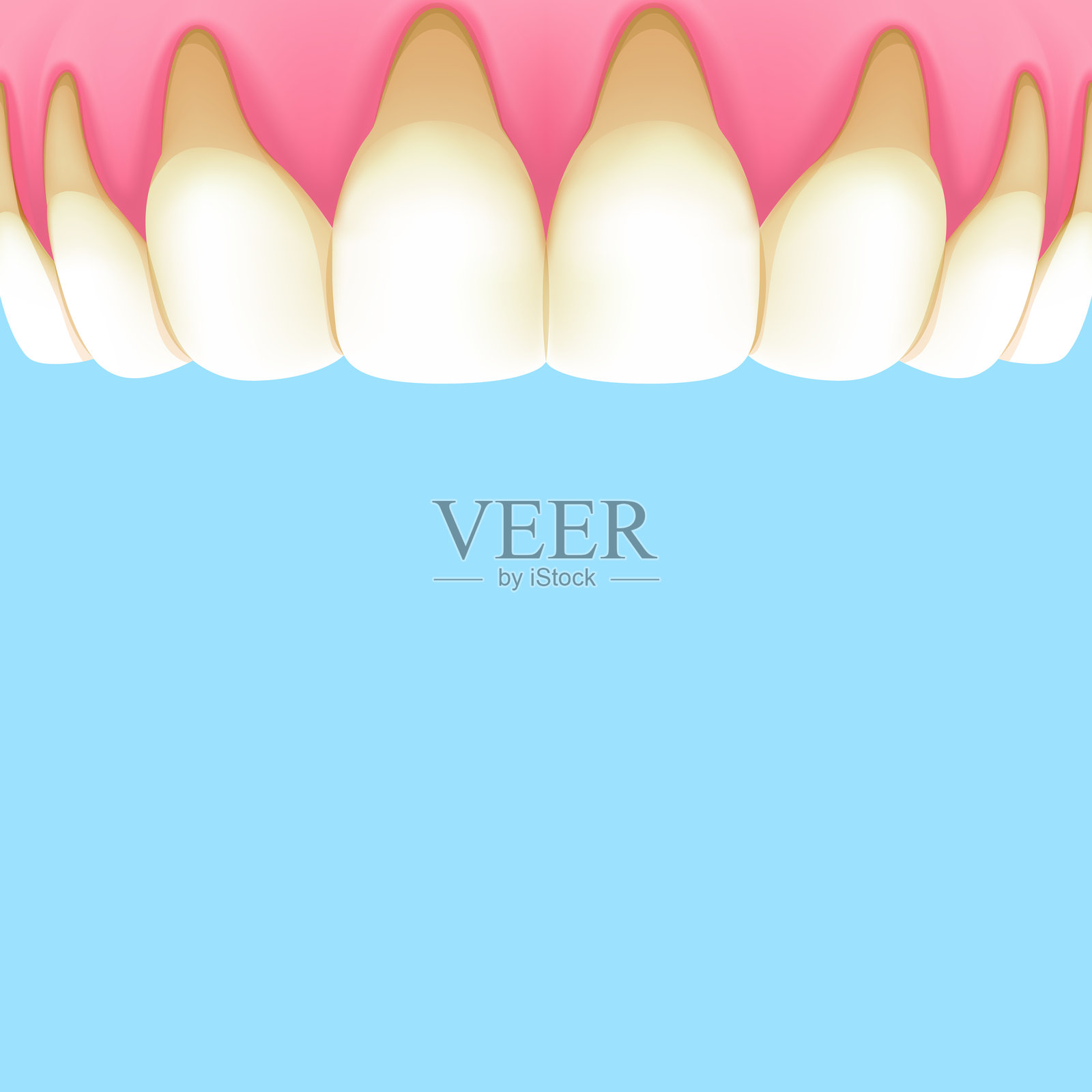 上颌牙齿(牙龈退缩)-文本框横幅(方形)插图矢量设计。牙科护理概念。插画图片素材
