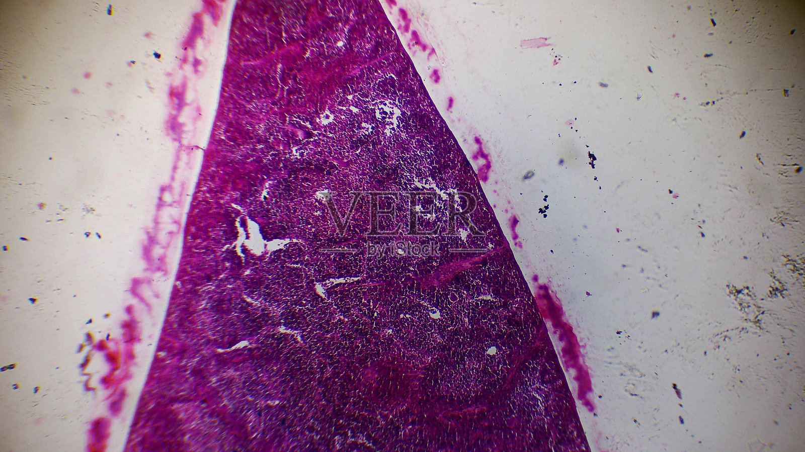 染色组织样本的显微镜视图照片摄影图片