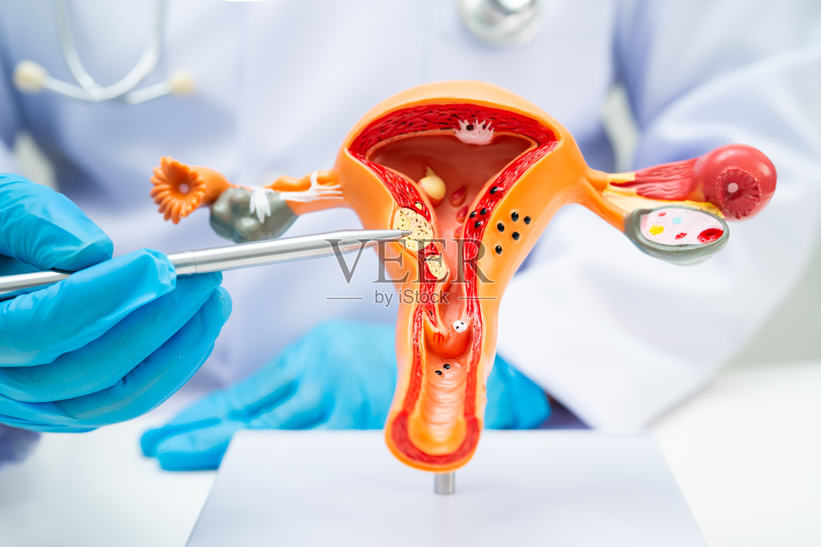 医生在医院手持子宫人体解剖模型进行研究、诊断和治疗。照片摄影图片