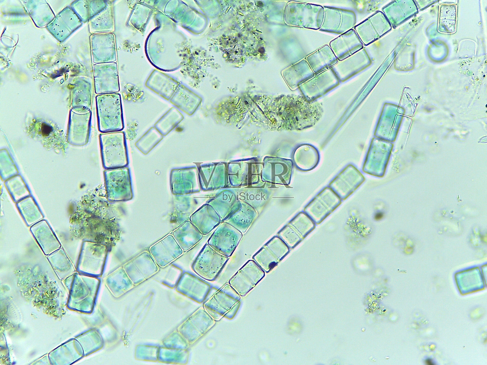 显微镜下观察到硅藻梅洛西拉形成厚孢子照片摄影图片