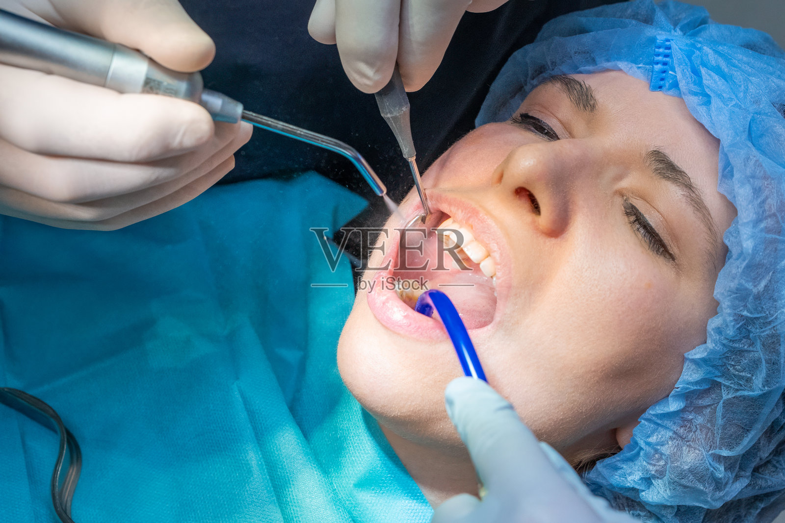 牙科团队为女性患者进行口腔外科手术。照片摄影图片