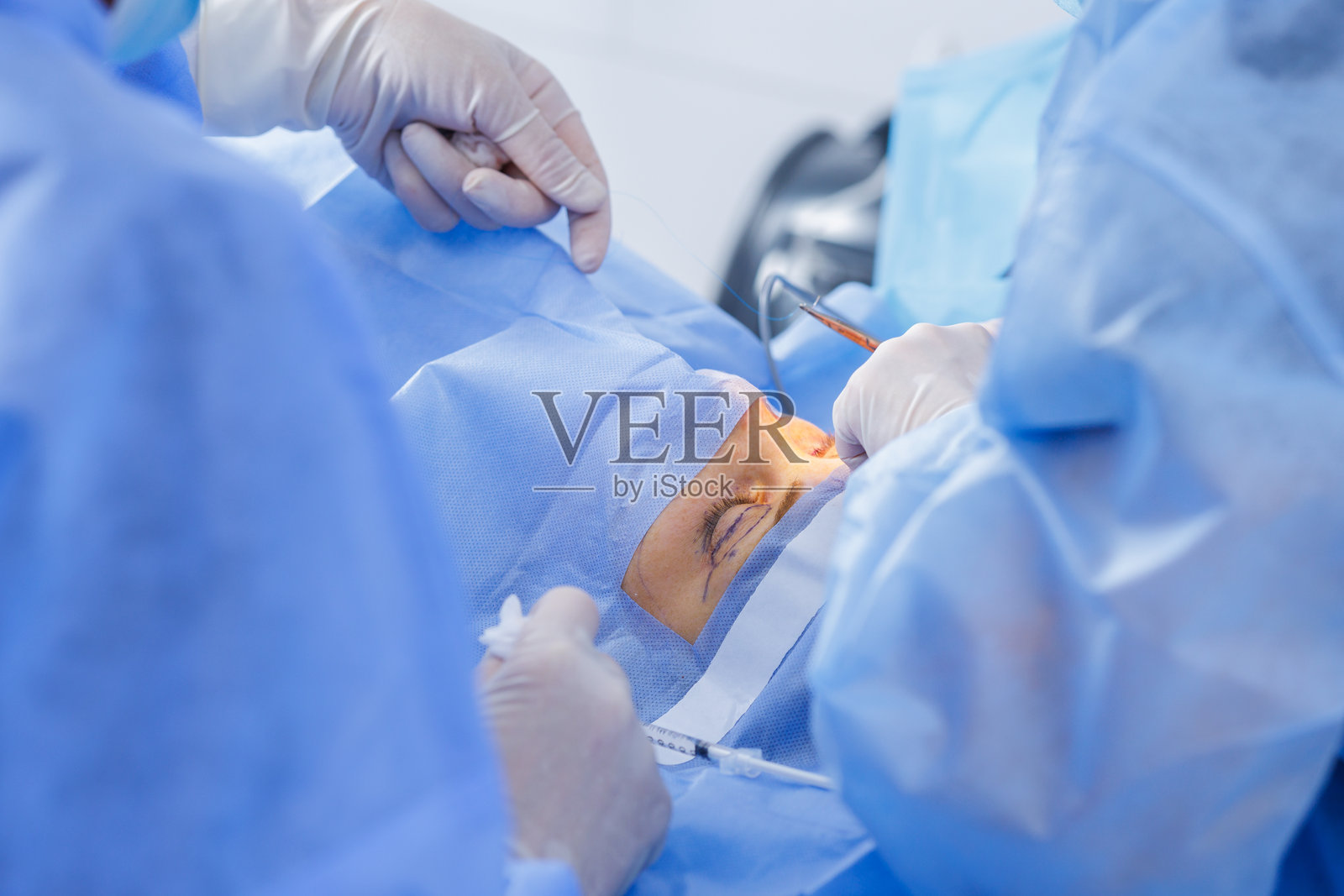 无菌手术室局部麻醉下的重睑术缝合照片摄影图片