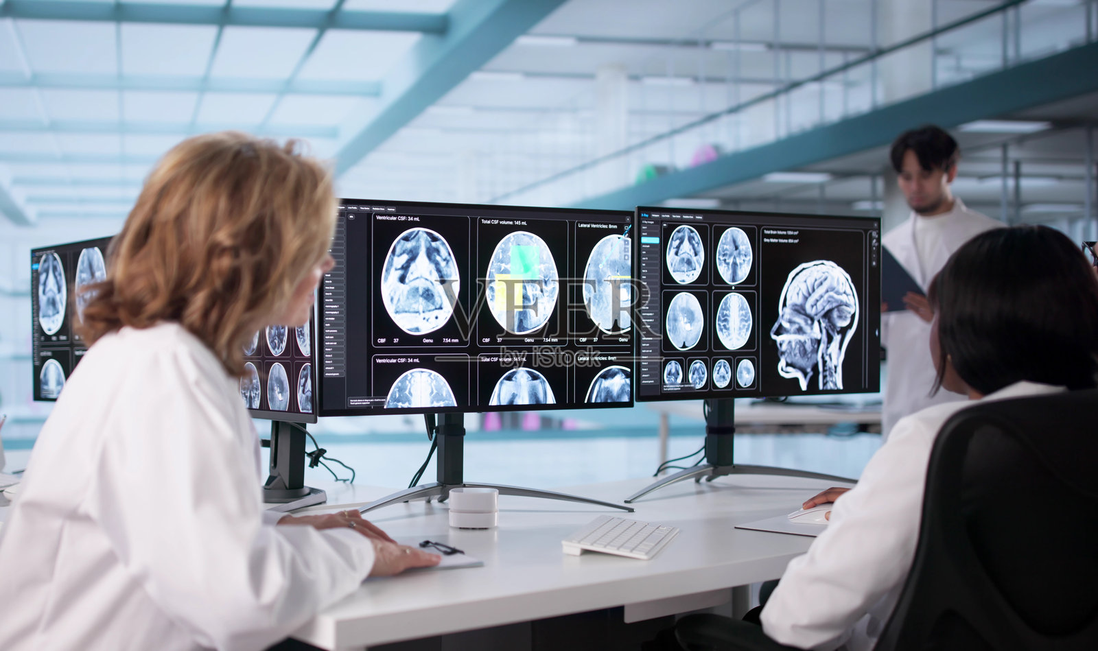 神经科医生正在检查MRI扫描以诊断脑损伤照片摄影图片