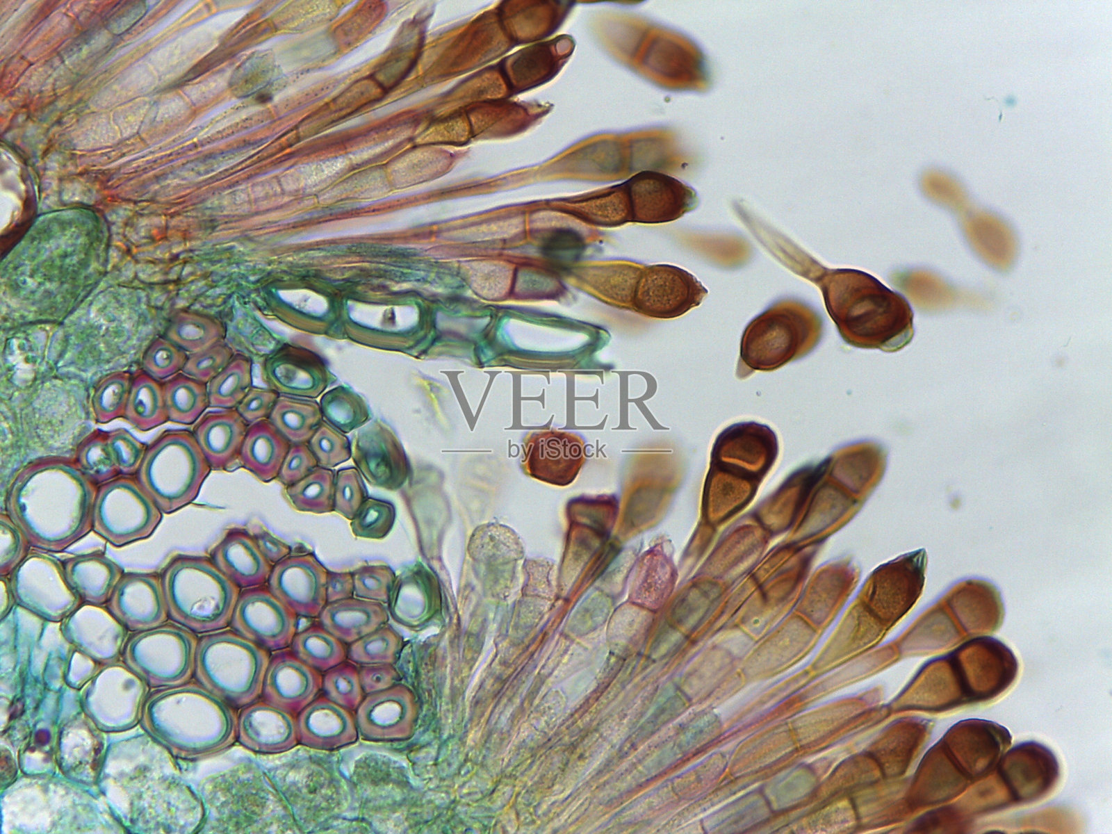 担子菌门锈菌生命周期:染色制剂显示成熟的双核菌丝体和担孢子以度过冬季照片摄影图片