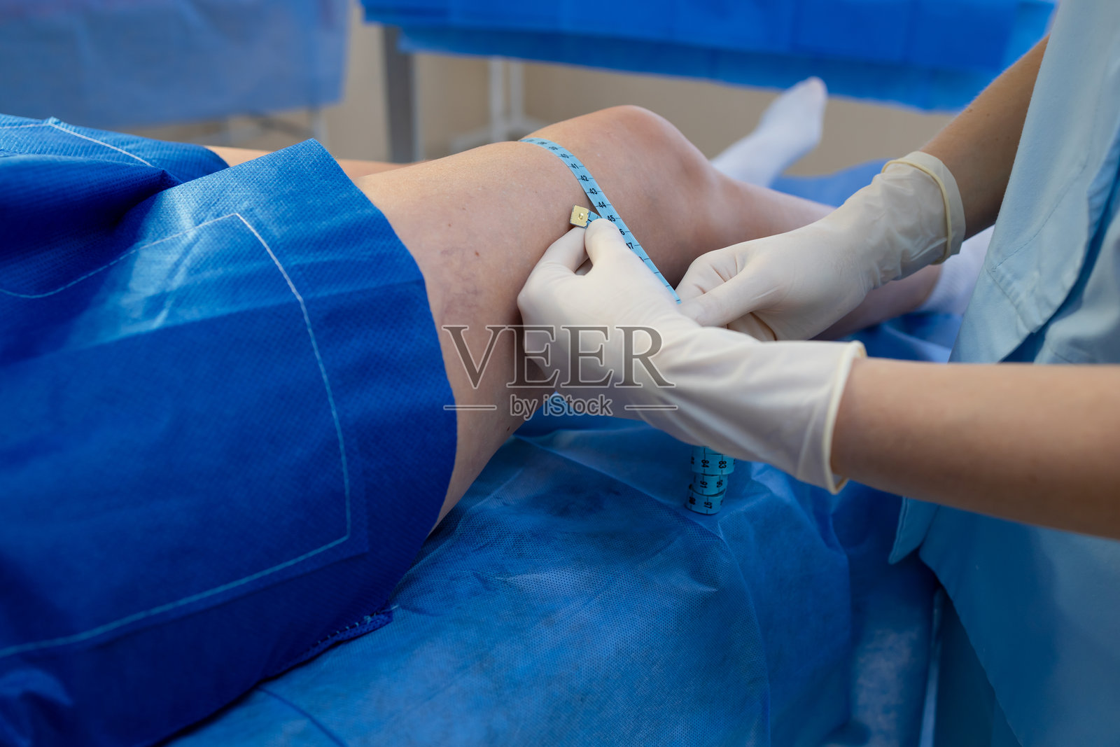 血管外科医生用卷尺测量腿长和周长照片摄影图片