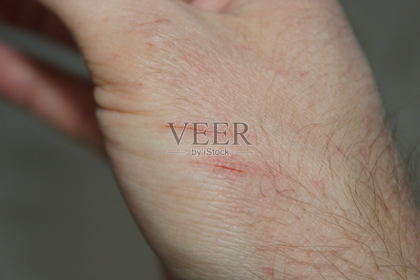 白天室内环境下,手上带有少量割伤和轻微出血的皮肤照片摄影图片