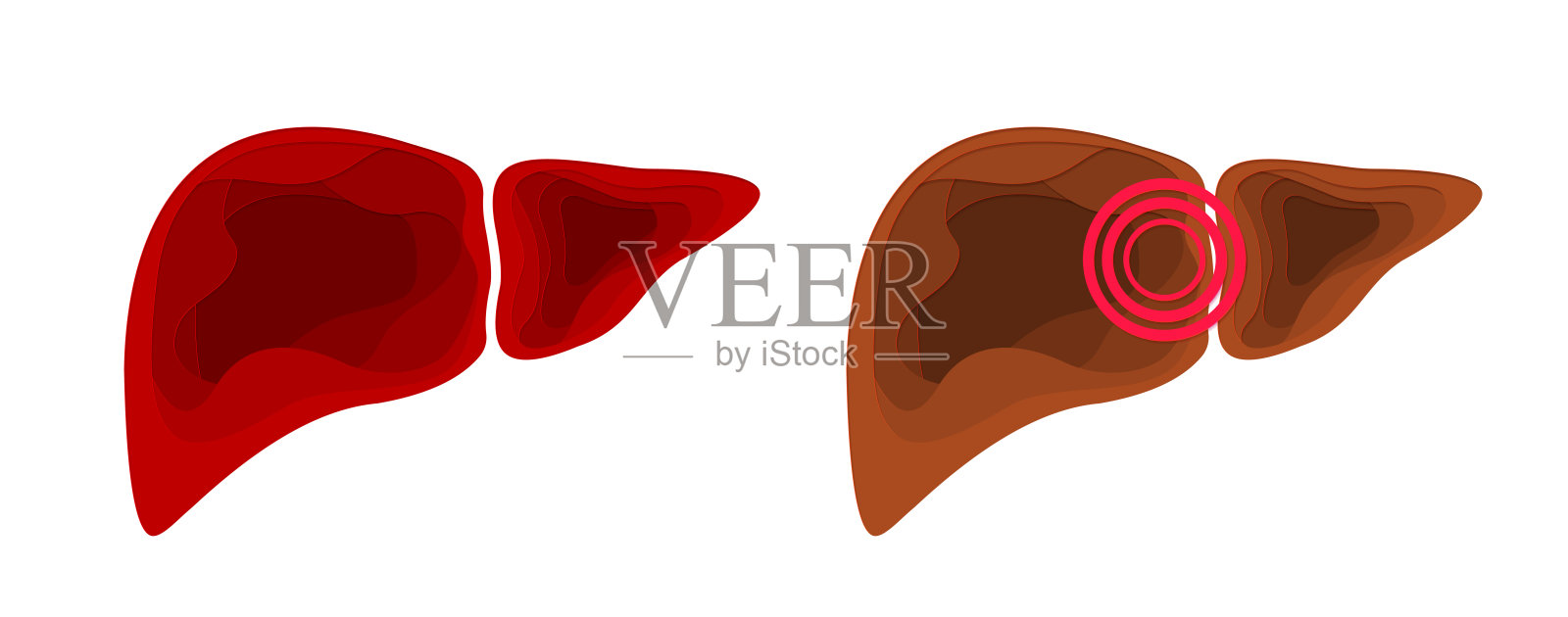 肝脏。健康与疼痛。剪纸设计元素。医疗矢量分层插图。插画图片素材