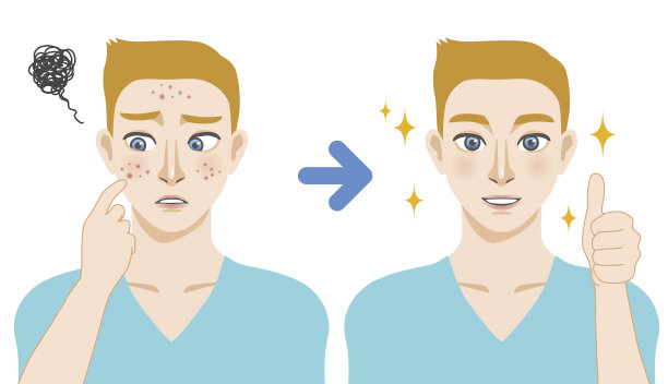 青春痘治疗前后,洁面泡沫,男士护肤,卡通插画图片 青春痘治疗前后,洁面泡沫,男士护肤,卡通插画图片下载
