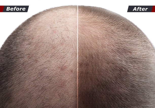 男士发梢后用化妆粉、面霜、喷雾使头发浓密图片 男士发梢后用化妆粉、面霜、喷雾使头发浓密图片下载