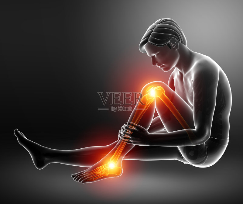 疼痛的腿正版插画素材