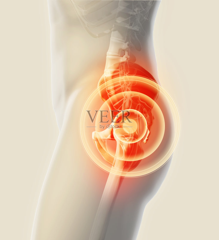 髋部疼痛的骨骼x光,3D插图。正版图片素材