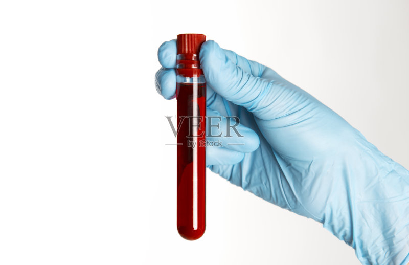 手上拿着血样取样管正版图片素材