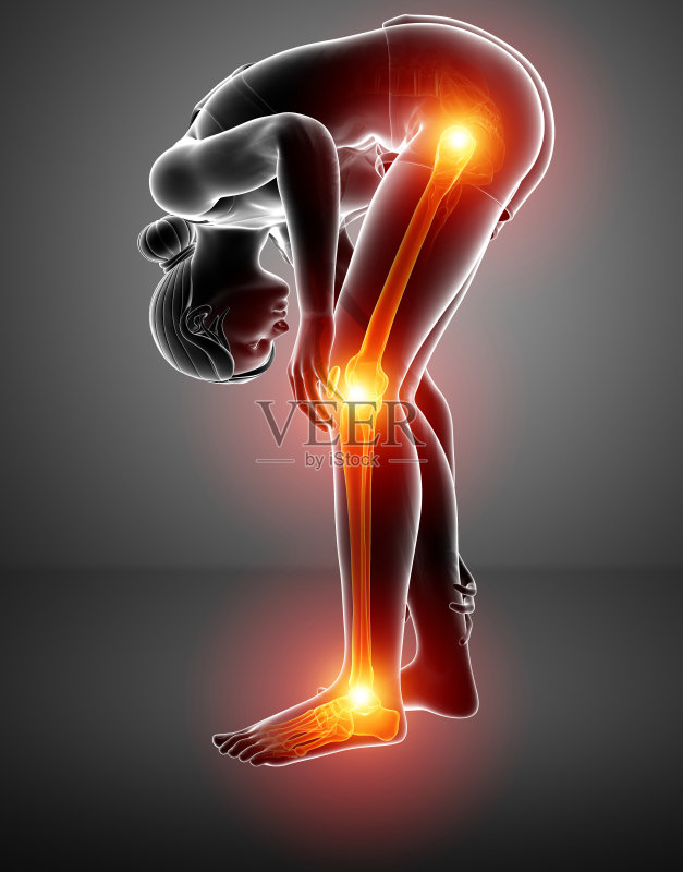 疼痛的腿正版图片素材