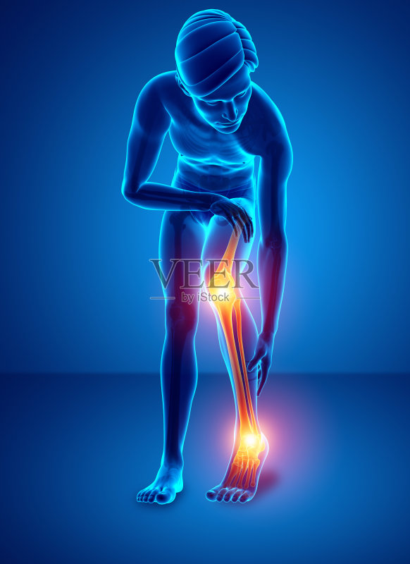 疼痛的腿正版图片素材