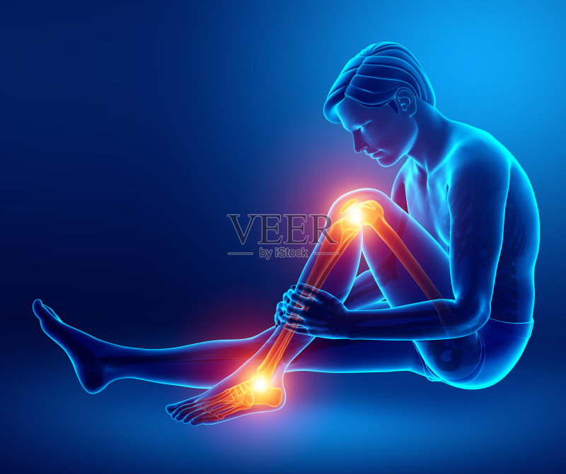 疼痛的腿正版插画素材