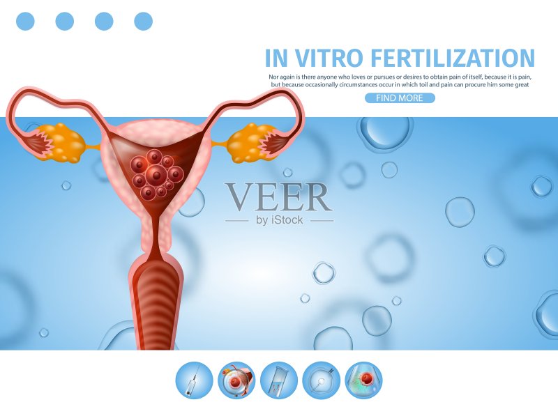 试管受精信息援助横幅。正版插画素材