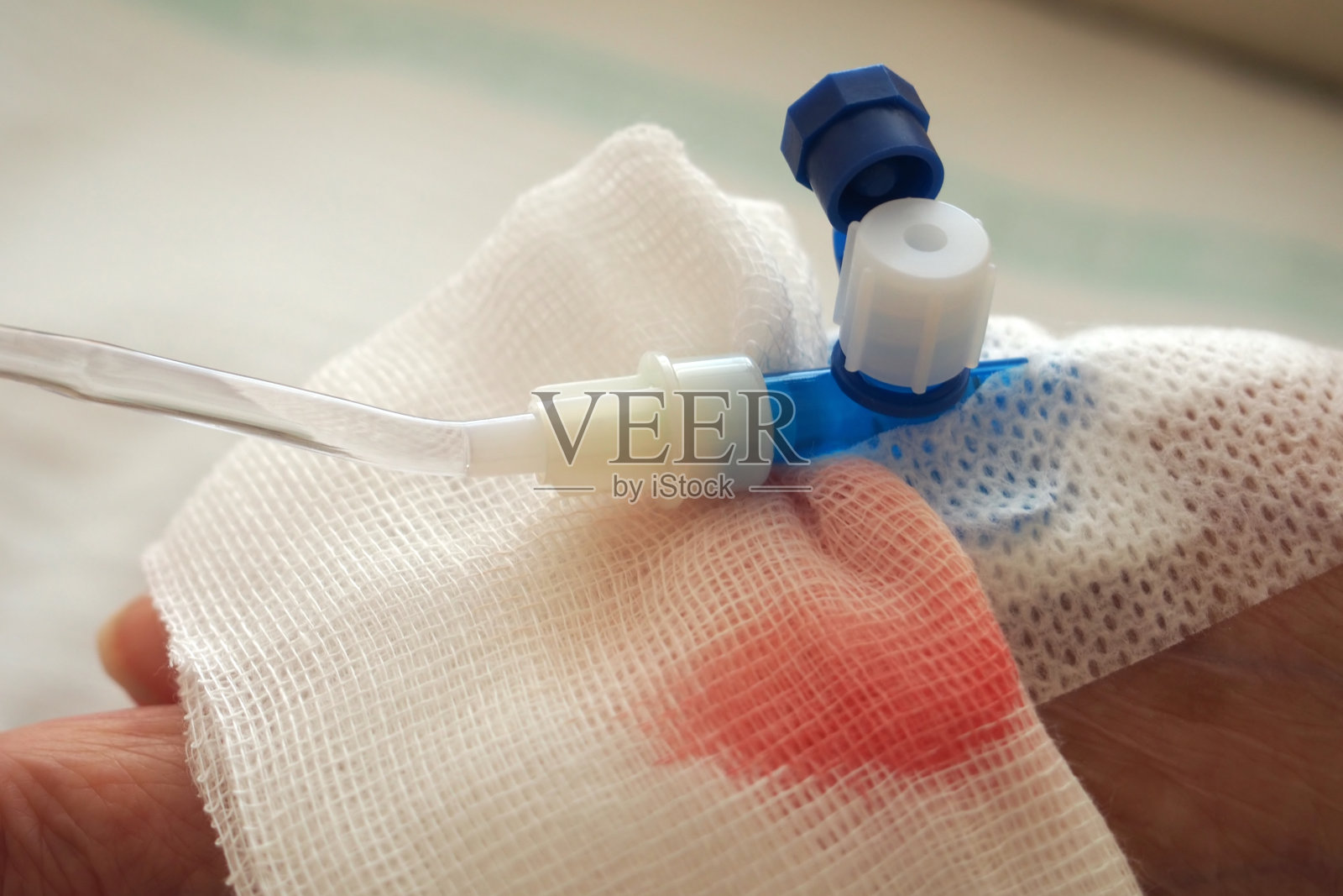 手持导管插入静脉照片摄影图片