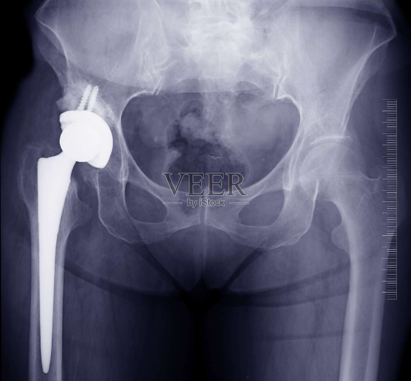 x射线照片摄影图片