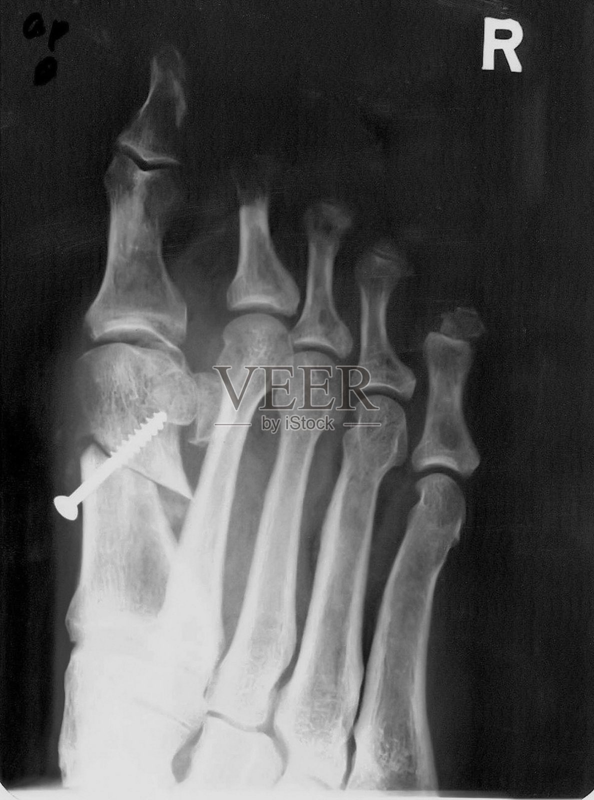 操作照片摄影图片