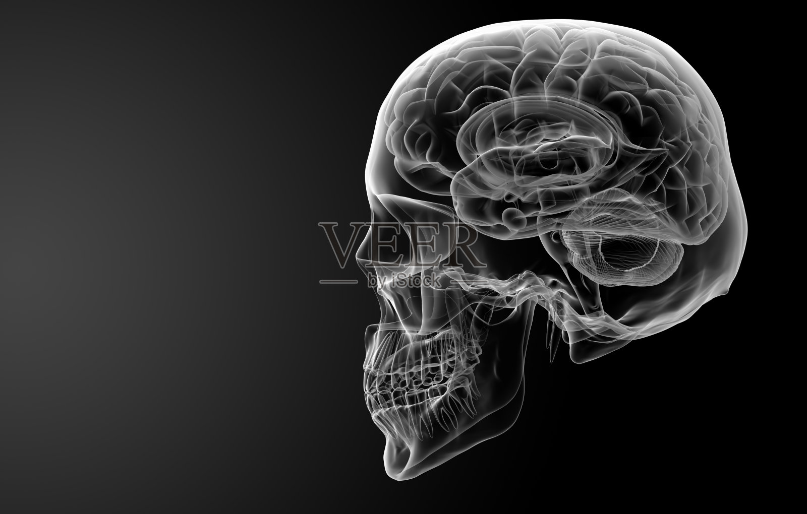 人脑X光片照片摄影图片