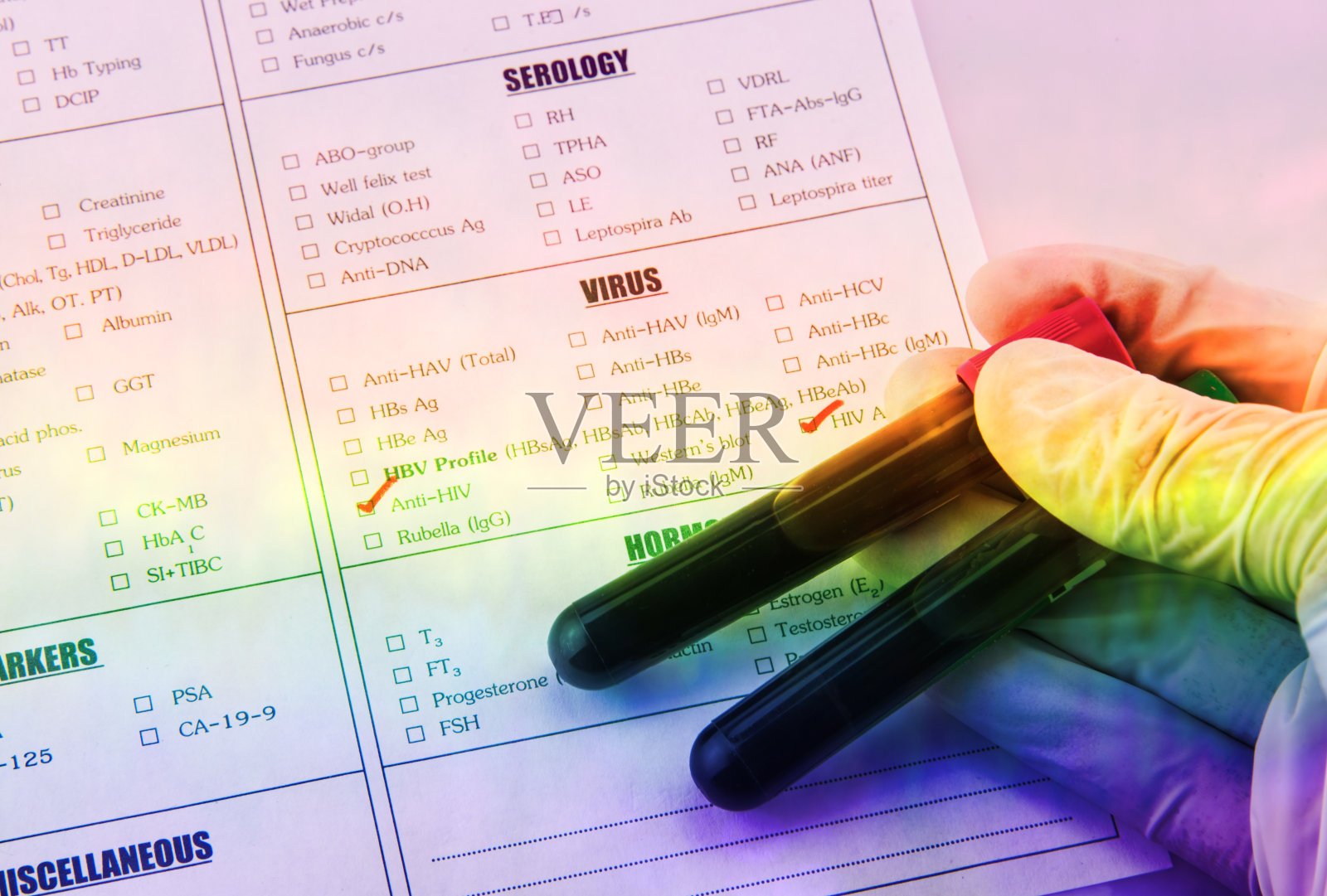 血液样本和实验室要求进行抗hiv检测照片摄影图片