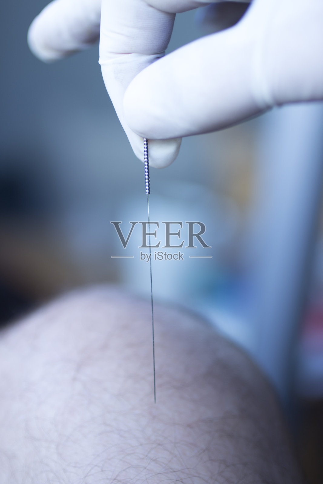 针刺针干刺照片摄影图片