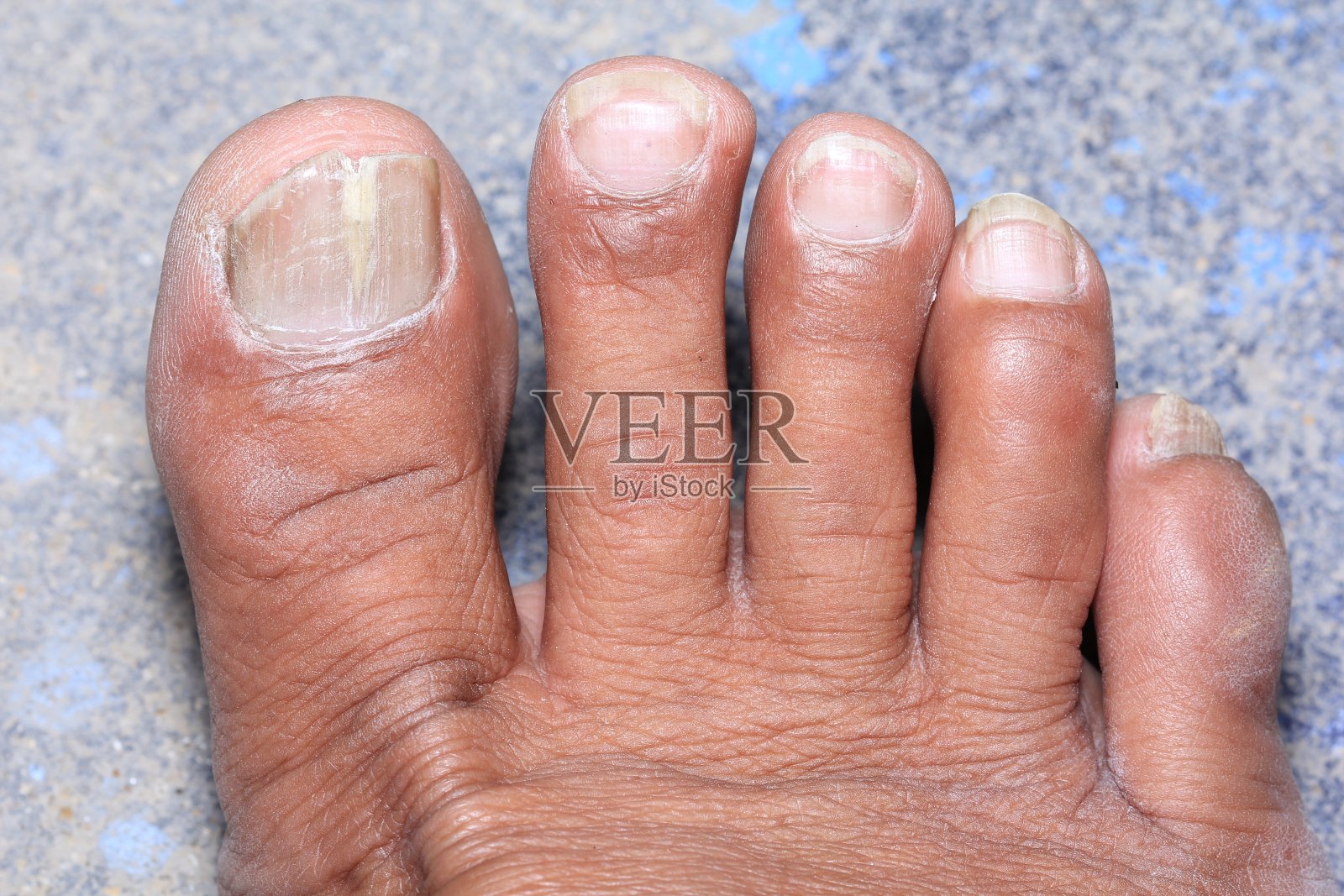 脚照片摄影图片