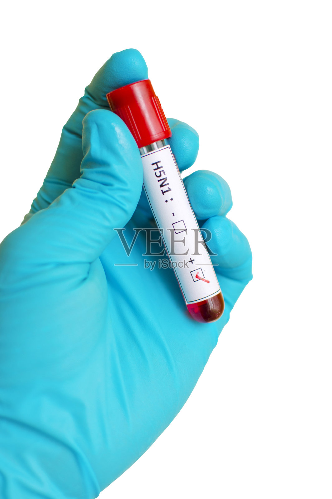 H5N1流感阳性照片摄影图片