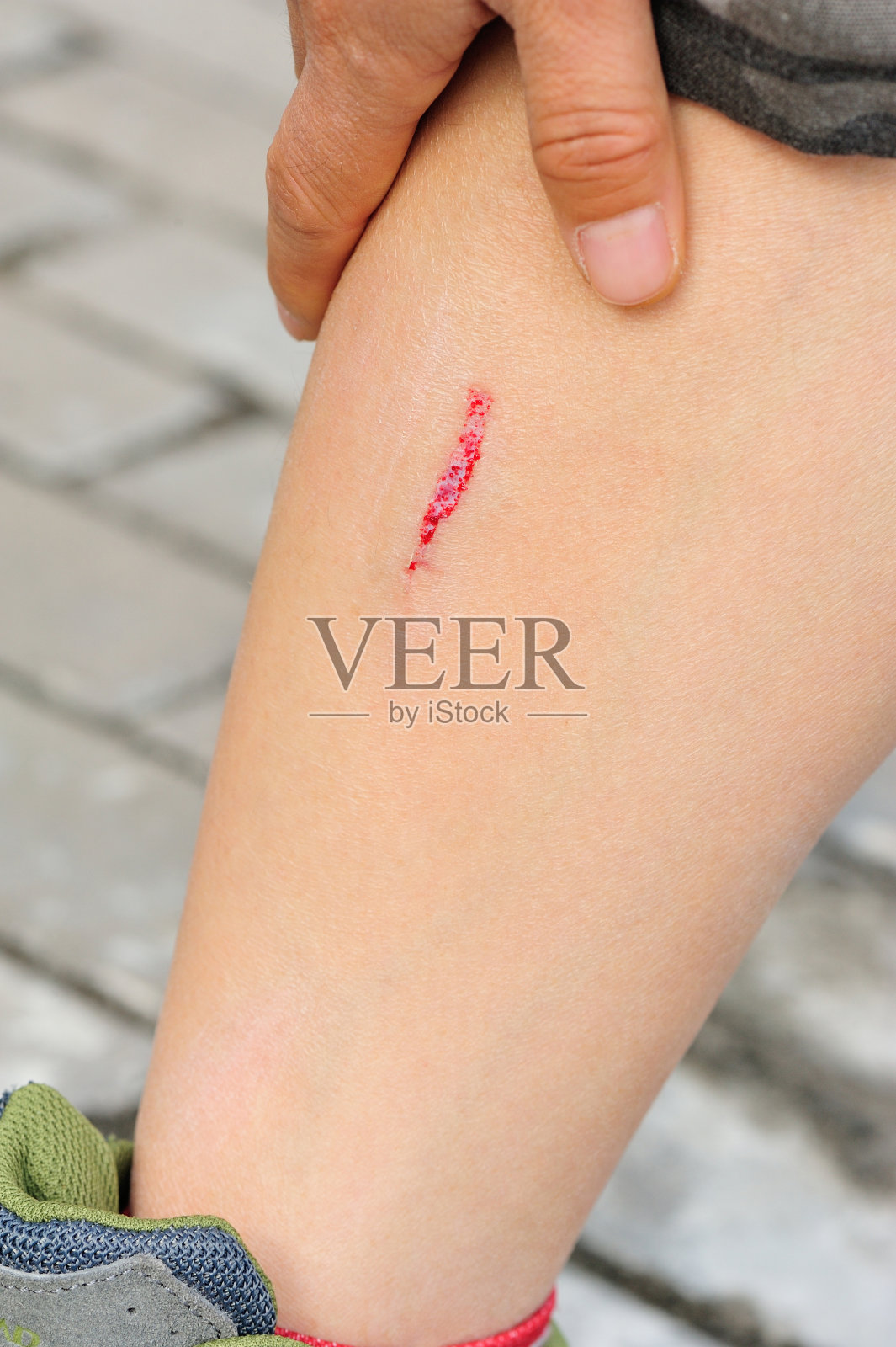 运动受伤的腿照片摄影图片