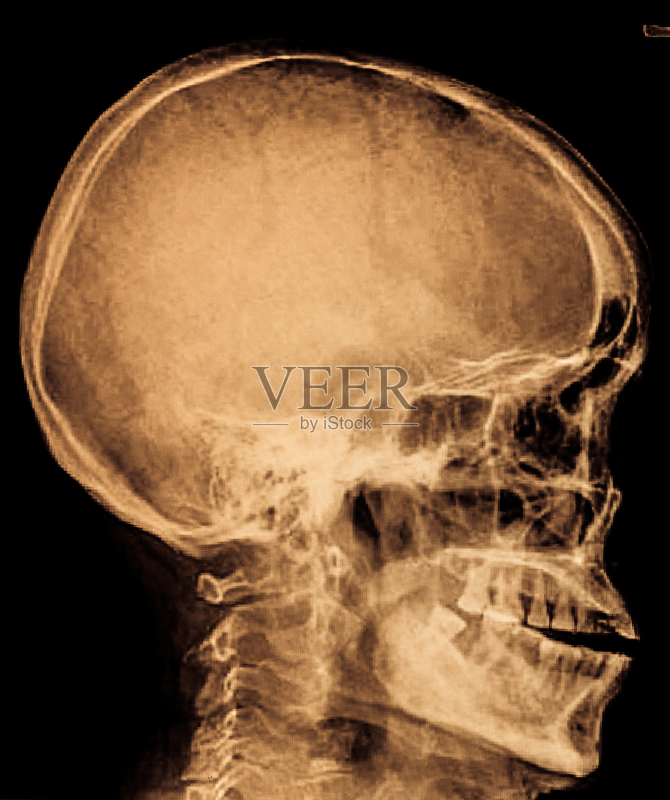 胶片X光头骨侧位片照片摄影图片