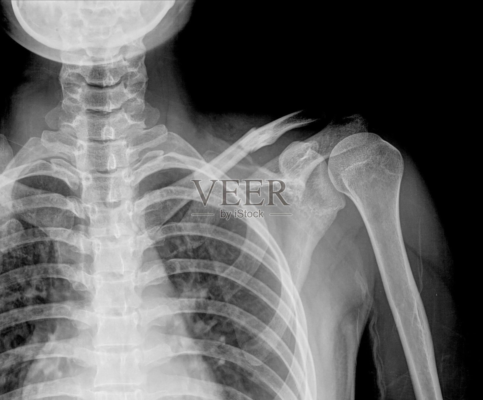 x射线照片摄影图片