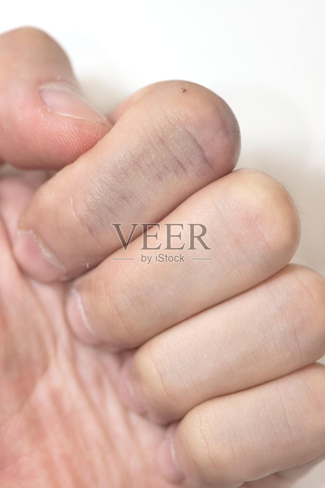 食指上有黑色的血管照片摄影图片