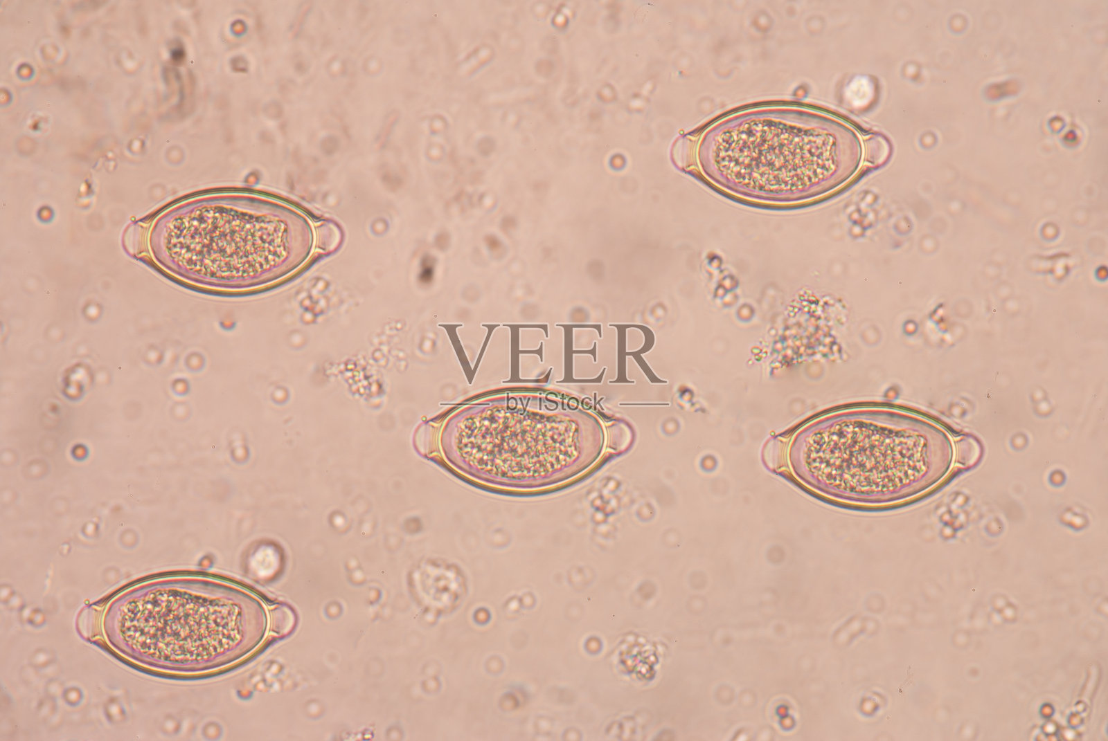 人鞭虫照片摄影图片