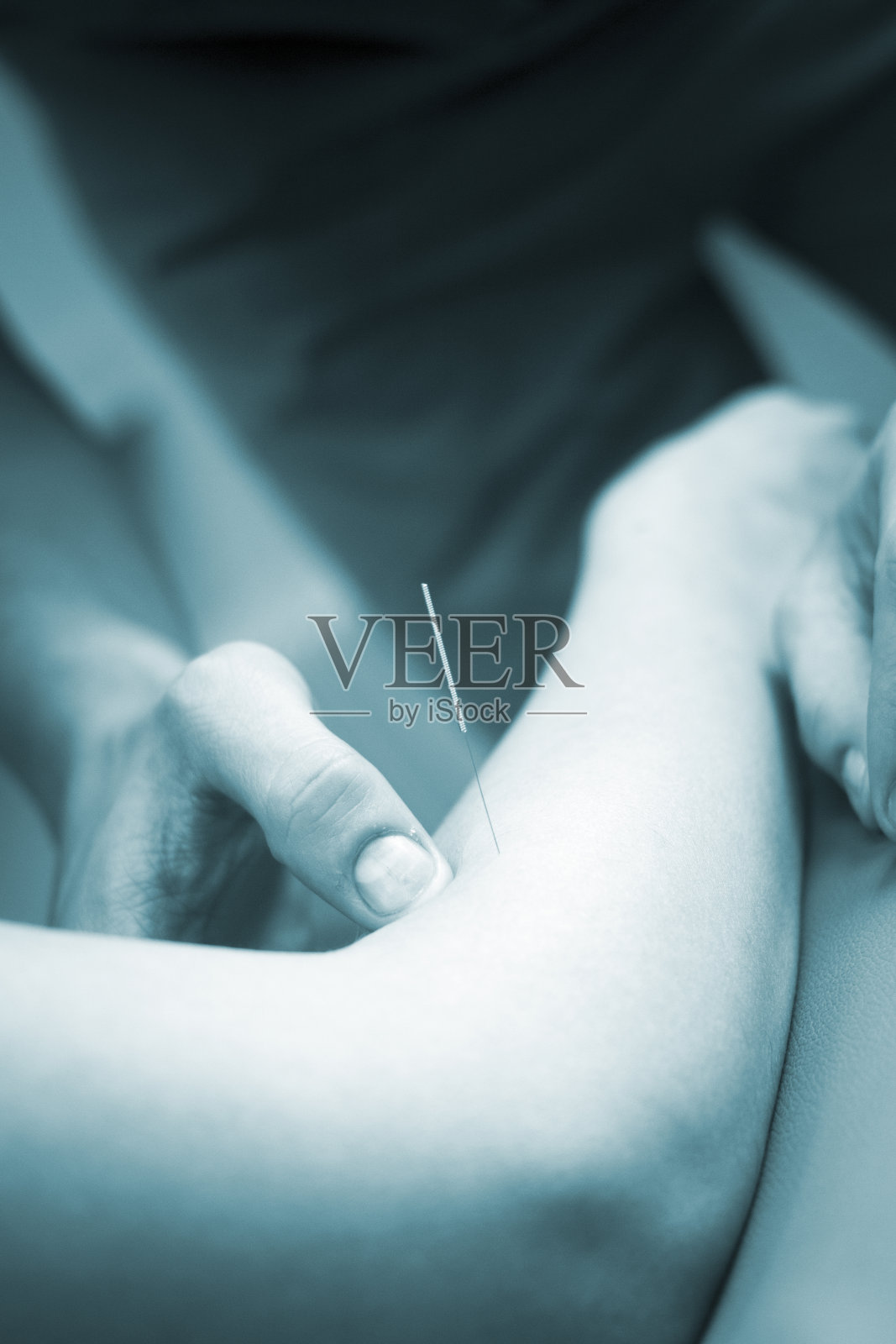 医生用手针灸病人的手臂照片摄影图片